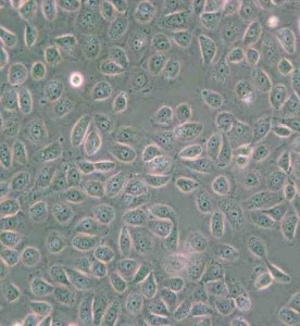 5637人膀胱癌細(xì)胞主圖
