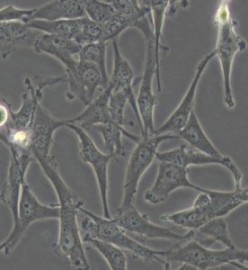 A172人膠質母細胞瘤細胞主圖