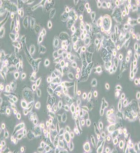 AsPC-1人轉移胰腺腺癌細胞主圖
