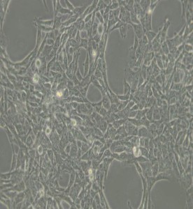 HBL-100人整合SV40基因的乳腺上皮細胞主圖
