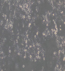 HCCC-9810人膽管細(xì)胞型肝癌細(xì)胞主圖