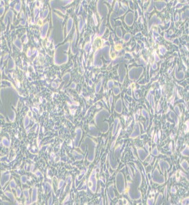 LNCaP clone FGC人前列腺癌細胞主圖