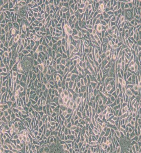 B82小鼠腫瘤細胞系主圖