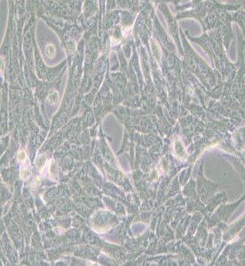 Panc02小鼠胰腺癌細胞主圖