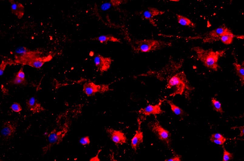 大鼠肺微血管內(nèi)皮細(xì)胞主圖