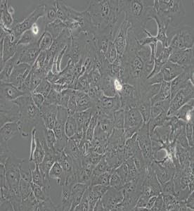 RBE人肝膽管癌細(xì)胞主圖