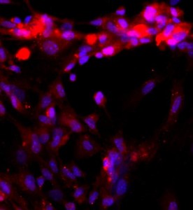大鼠肝竇內皮細胞主圖