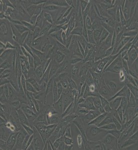 Saos-2人成骨肉瘤細胞主圖