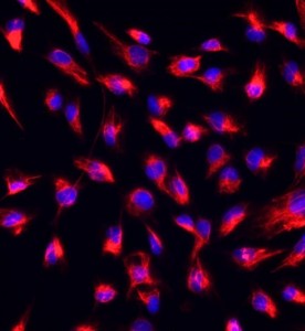 大鼠心肌成纖維細胞主圖