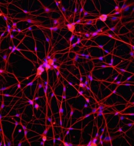 大鼠背根神經(jīng)元細胞主圖