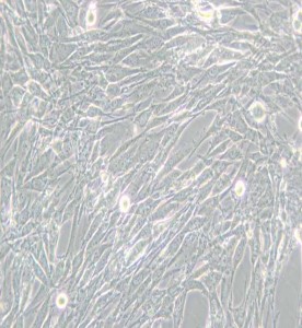 U-118 MG人腦星形膠質母細胞瘤主圖