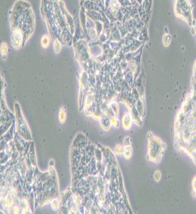 VCaP人前列腺癌細胞主圖