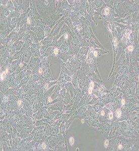 TTA1人甲狀腺癌細(xì)胞主圖