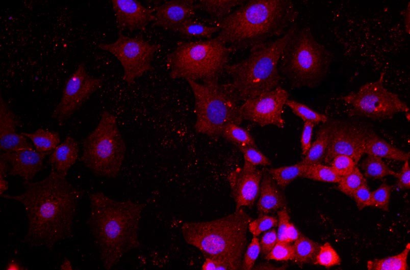 小鼠卵巢顆粒細胞主圖