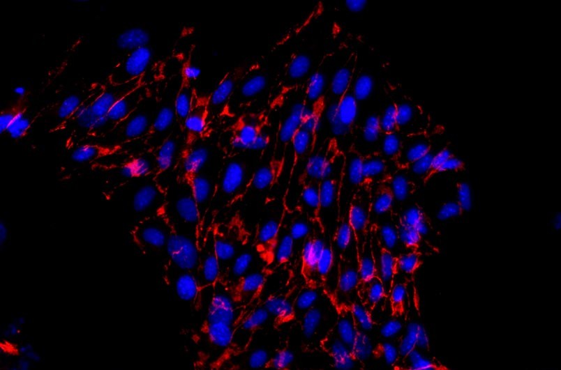 小鼠主動脈內(nèi)皮細胞主圖