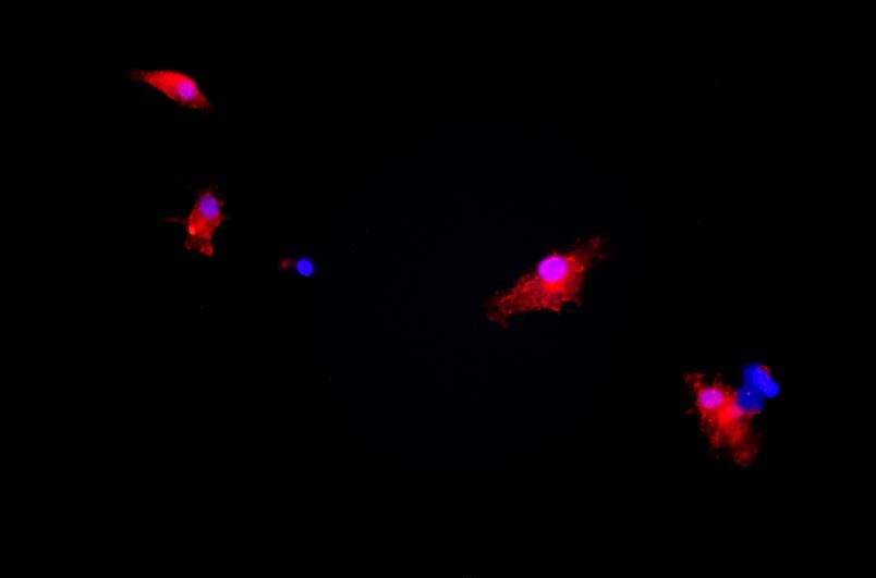 小鼠神經小膠質細胞主圖