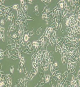 AN3 CA人子宮內膜腺癌細胞主圖
