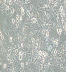 Anglne人卵巢癌細(xì)胞主圖