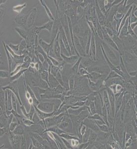 HUV-EC-C[HUVEC]人臍靜脈血管內皮細胞主圖