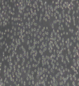 JeKo-1人套細胞淋巴瘤細胞主圖