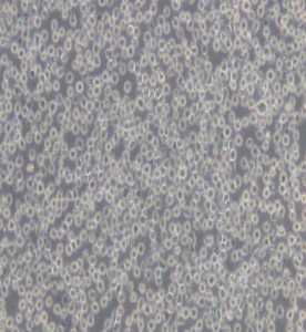 Jurkat clone A3[A3]人T淋巴細胞白血病細胞主圖