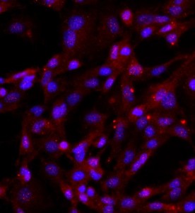 人關節軟骨細胞主圖