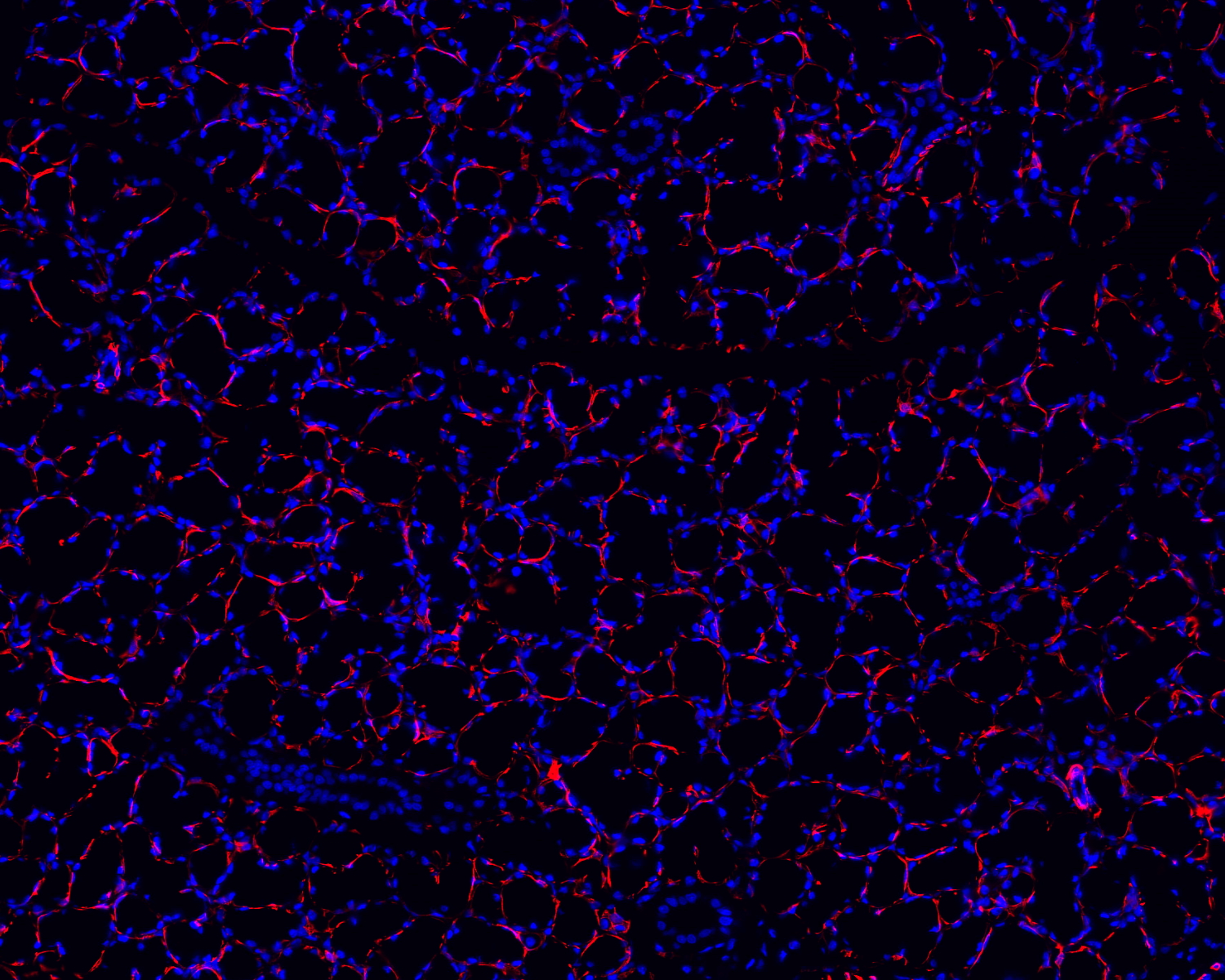 免疫熒光單標(biāo)雙色染色主圖