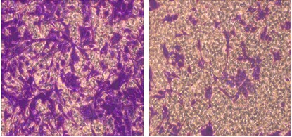 細(xì)胞侵襲結(jié)果示意圖